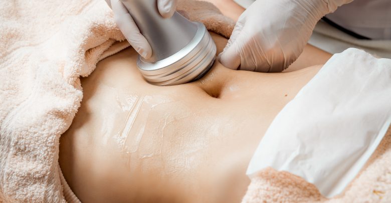 SculpSure procedure