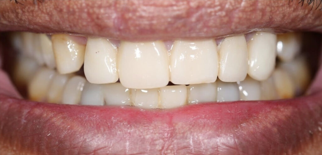 Marwan Obeidi Dentist Dubai