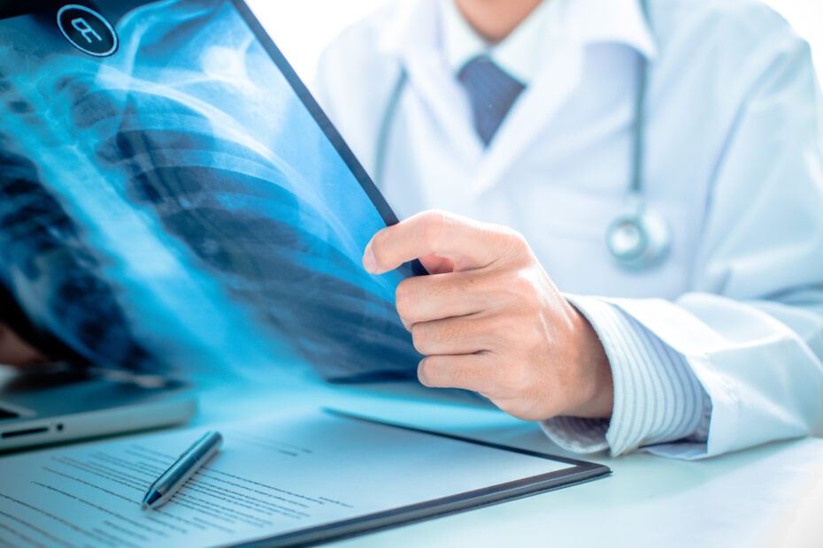 lung transplant cost