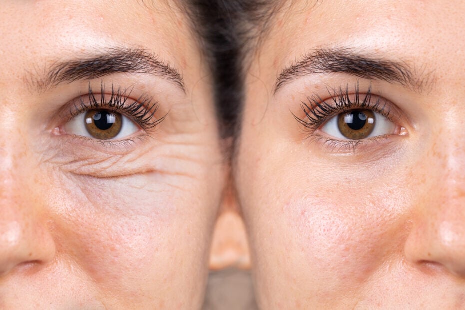 best eyelid surgeons dubai